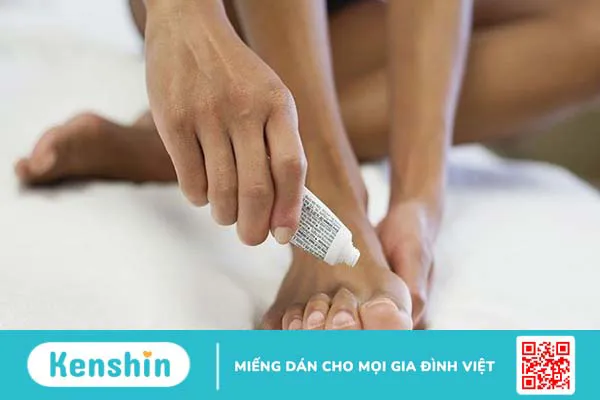 Bệnh nấm kẽ chân (nước ăn chân) – bệnh thường gặp mùa mưa bạn cần biết