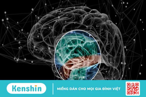 Bệnh tâm thần có di truyền không? Tại sao dễ mắc bệnh?