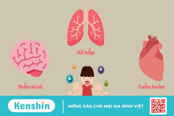 Bệnh tay chân miệng có lây không? Tay chân miệng lây qua đường nào?