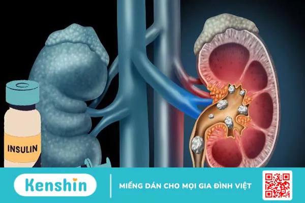 Bệnh tiểu đường ăn chuối được không? 6 lợi ích tốt cho bệnh tiểu đường