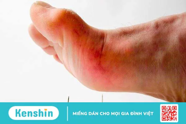 Bệnh truyền nhiễm là gì? Danh sách các bệnh truyền nhiễm thường gặp