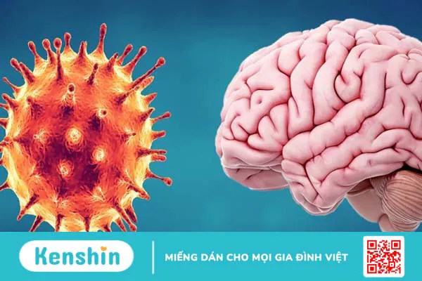 Bệnh viêm phổi cấp do nhiễm Virus corona