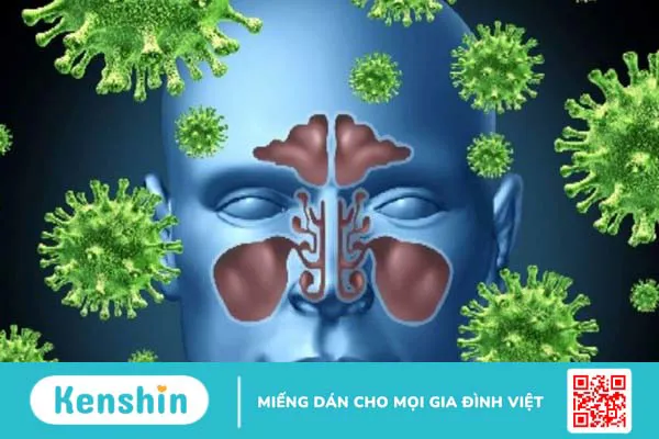 Bệnh viêm xoang có lây không? Cách phòng ngừa bệnh viêm xoang hiệu quả