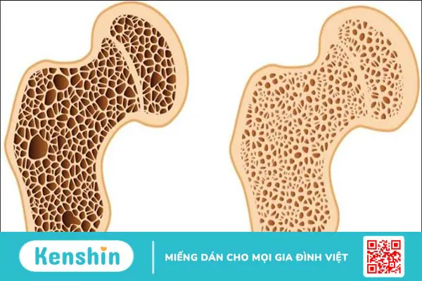 Beta Glucan là gì? 8 Tác dụng, cách dùng, tác dụng phụ khi sử dụng thực phẩm chứa Beta Glucan