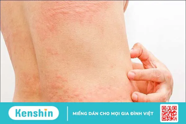 Beta Glucan là gì? 8 Tác dụng, cách dùng, tác dụng phụ khi sử dụng thực phẩm chứa Beta Glucan