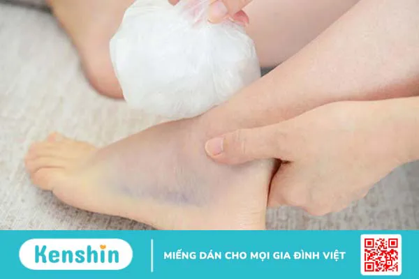 Bị bong gân chân nên làm gì? Mách bạn cách sơ cứu hiệu quả, nhanh chóng