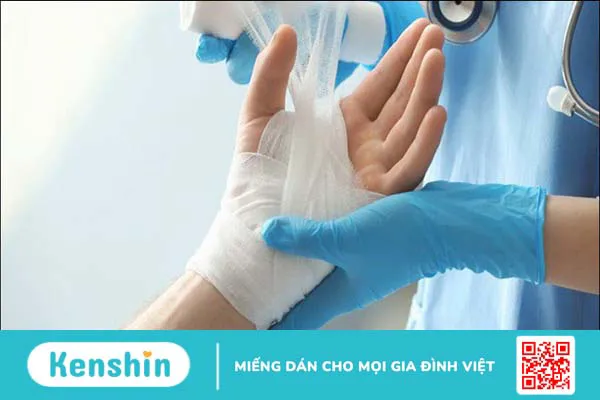 Bị bỏng nên làm gì? 12 mẹo trị phỏng nước sôi, bỏng lửa hiệu quả