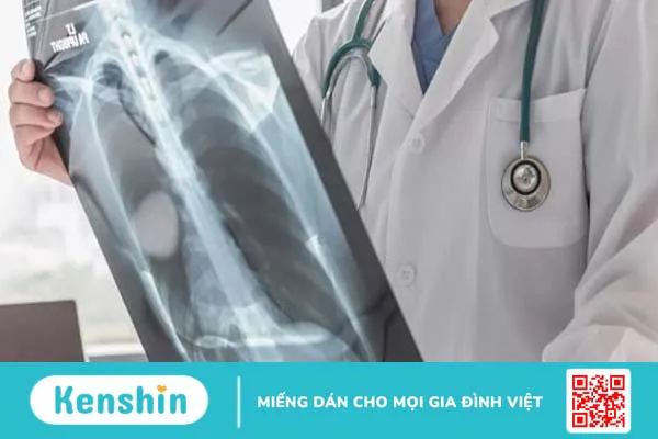 Bị bỏng nên làm gì? 12 mẹo trị phỏng nước sôi, bỏng lửa hiệu quả