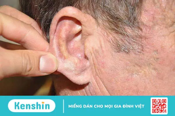 Bị chảy máu tai là bệnh gì? 6 nguyên nhân chảy máu tai bạn nên biết