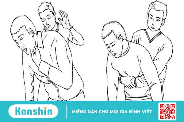 Bị mắc (hóc) xương cá ở cổ họng phải làm sao? 10 mẹo chữa hóc xương