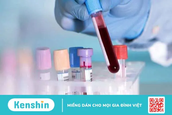 Bị sỏi thận nên ăn gì? 12 loại thực phẩm trị sỏi thận tại nhà an toàn, hiệu quả