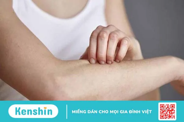 Bị thủy đậu kiêng gì? 5 thực phẩm cần tránh và lưu ý khi bị thủy đậu