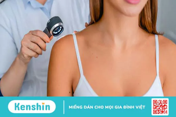 Bị zona thần kinh kiêng gì? 3 loại thực phẩm không nên ăn khi bị zona