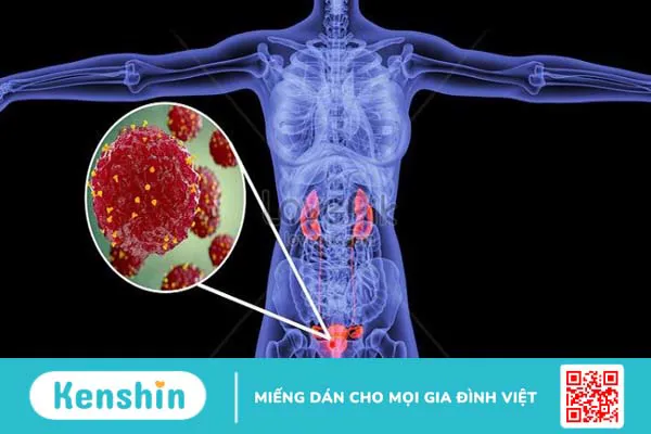 Biến chứng sau khi mổ u xơ tử cung là gì? 9 biến chứng có thể gặp