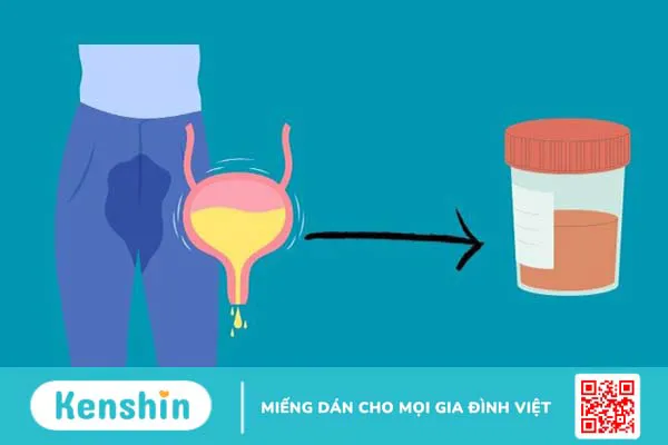 Biến chứng sau khi mổ u xơ tử cung là gì? 9 biến chứng có thể gặp