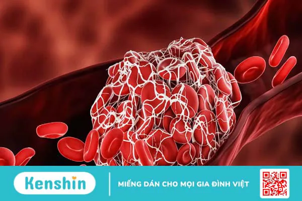 Biotin là gì? Cách sử dụng trị rụng tóc HIỆU QUẢ, NHANH và lưu ý