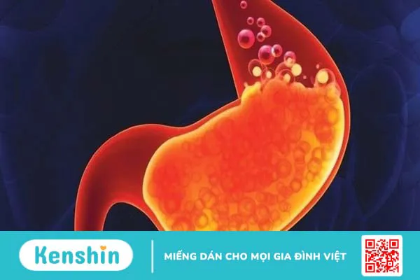 Bồ công anh có thể trị đau dạ dày không?