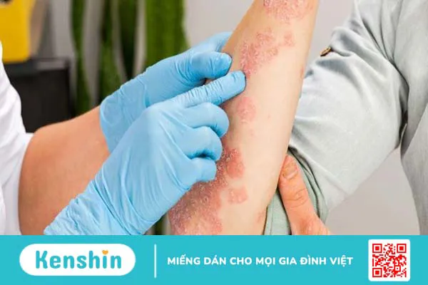 Bông cải xanh là gì? 14 Tác dụng của bông cải xanh đối với sức khỏe bạn cần biết