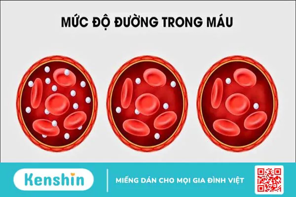 Bông cải xanh là gì? 14 Tác dụng của bông cải xanh đối với sức khỏe bạn cần biết