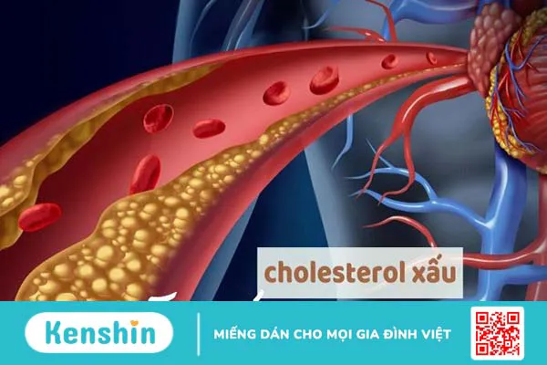 Bông cải xanh là gì? 14 Tác dụng của bông cải xanh đối với sức khỏe bạn cần biết