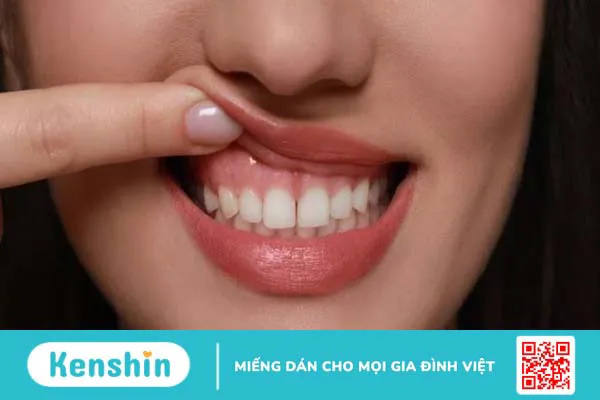 Bông cải xanh là gì? 14 Tác dụng của bông cải xanh đối với sức khỏe bạn cần biết