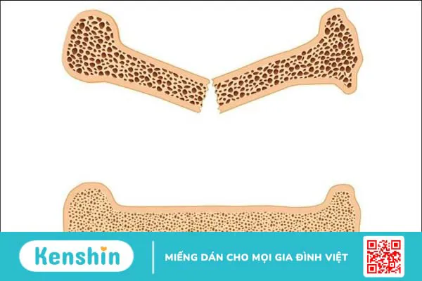 Bông cải xanh là gì? 14 Tác dụng của bông cải xanh đối với sức khỏe bạn cần biết