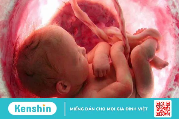 Bông cải xanh là gì? 14 Tác dụng của bông cải xanh đối với sức khỏe bạn cần biết