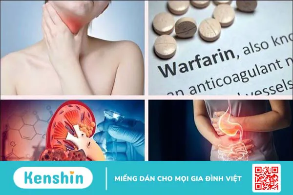 Bông cải xanh là gì? 14 Tác dụng của bông cải xanh đối với sức khỏe bạn cần biết