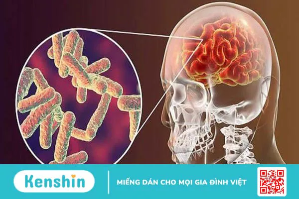 Bùng phát dịch virus Nipah: Cách phòng ngừa bệnh nên biết