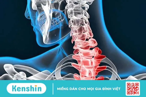 Các bệnh cơ xương khớp thường gặp nhất và cách điều trị