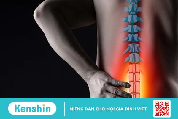 Các bệnh cơ xương khớp thường gặp nhất và cách điều trị