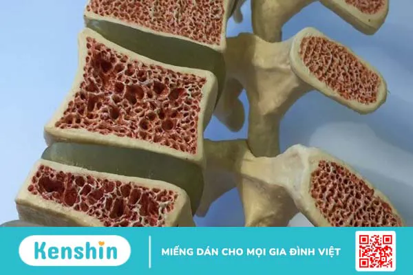 Các bệnh cơ xương khớp thường gặp nhất và cách điều trị