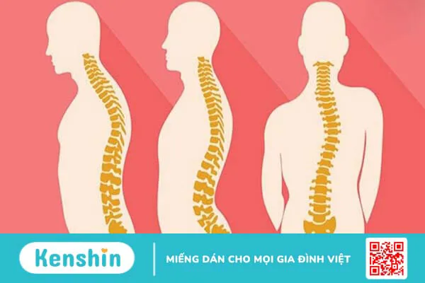 Các bệnh cơ xương khớp thường gặp nhất và cách điều trị