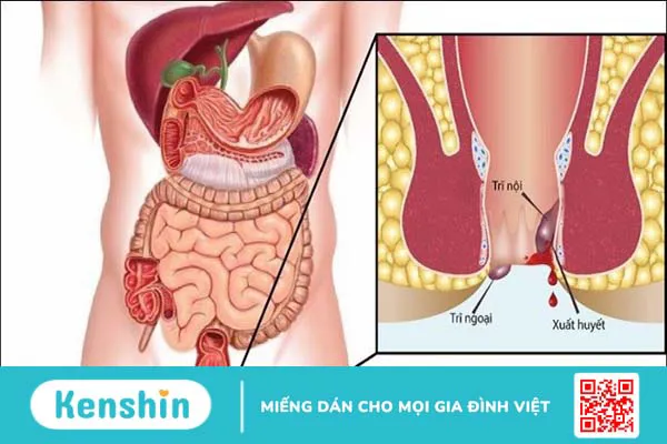 Các bệnh đường tiêu hóa thường gặp vào ngày lễ và cách phòng ngừa