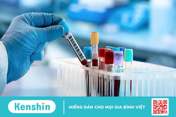 Các bệnh lây qua đường tình dục – 11 bệnh phổ biến cần cảnh báo