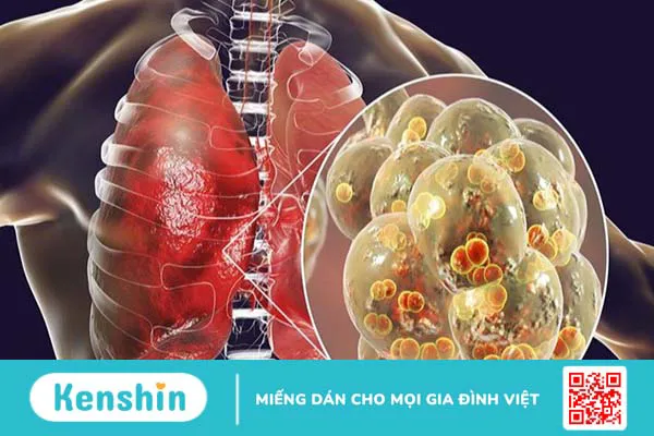 Các bệnh thường gặp khi giao mùa và cách phòng ngừa đơn giản, hiệu quả