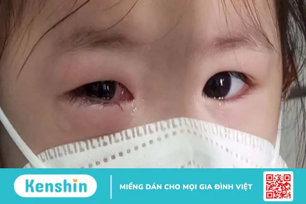 Các bệnh thường gặp khi giao mùa và cách phòng ngừa đơn giản, hiệu quả