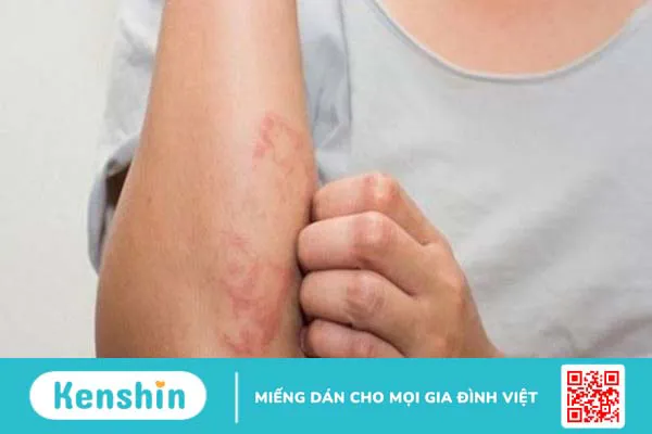 Các bệnh thường gặp khi giao mùa và cách phòng ngừa đơn giản, hiệu quả