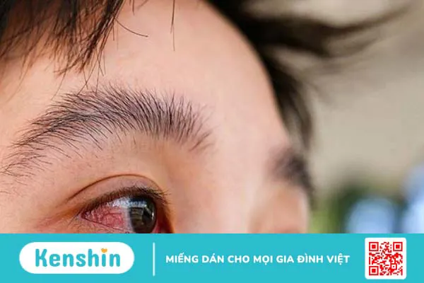 Các bệnh thường gặp khi thường xuyên tắm mưa và lưu ý sau khi tắm mưa