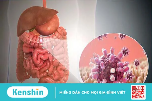 Các bệnh thường gặp vào mùa mưa và cách phòng tránh hiệu quả