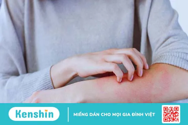 Các bệnh thường gặp vào mùa mưa và cách phòng tránh hiệu quả