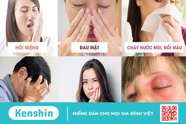 Các biến chứng viêm xoang gây nguy hiểm cho sức khỏe