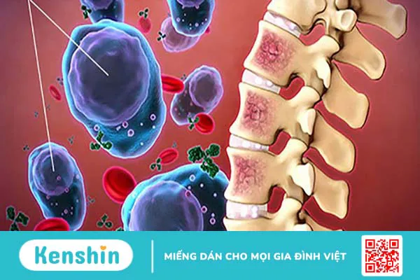 Các biến chứng viêm xoang gây nguy hiểm cho sức khỏe