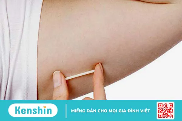 Các biện pháp tránh thai an toàn và hiệu quả nhất hiện nay