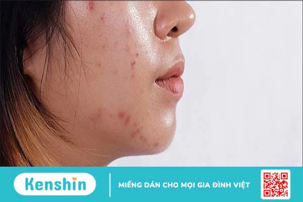 Các bước chăm sóc da cơ bản ban ngày và ban đêm cho mọi loại da mặt