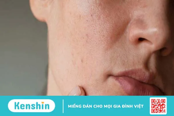 Các bước chăm sóc da khô đơn giản, hiệu quả giúp da ẩm mượt, tươi trẻ