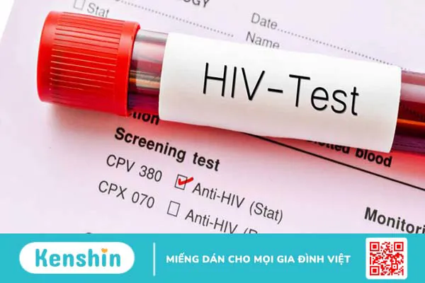 Các bước xử lý khi bị kim tiêm nghi nhiễm HIV đâm trúng