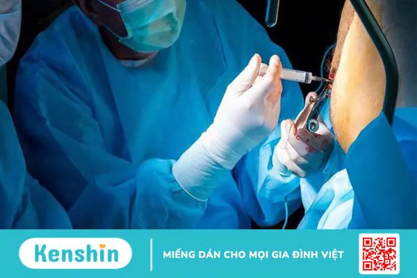 Các cách chữa bệnh trĩ tận gốc hiệu quả đơn giản và an toàn nhất