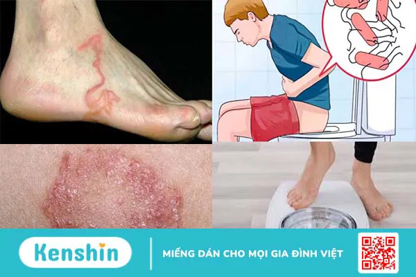 Các dấu hiệu nhiễm ký sinh trùng và quá trình chẩn đoán