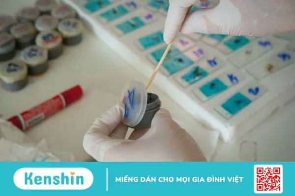 Các dấu hiệu nhiễm ký sinh trùng và quá trình chẩn đoán